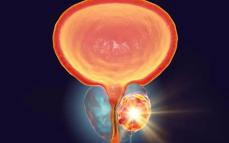 prostate-enlargement-services-provide-by-dr-aditya-sengar