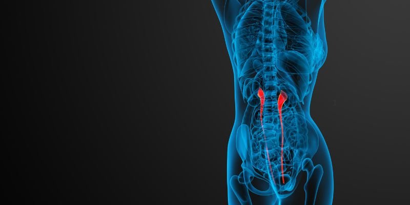 ureteric-stones-treatment-dr-aditya-sengar